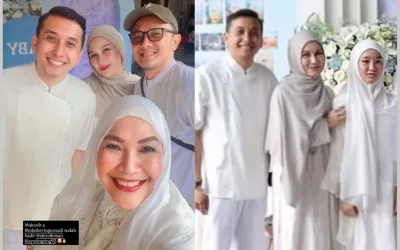 Bekas Luka di Wajah Kevin Gusnadi Terlihat, Efek Insiden Malam Minggu bareng Ayu Ting Ting